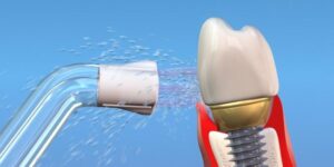 Waterpik™ Wp-100-Wp-450 Replacement Nozzle 2 Uts - Afbeelding 3