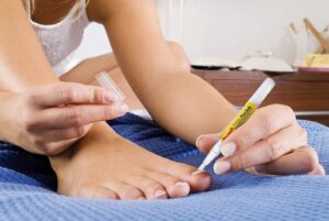 Pensek - Anti-schimmel pen - kalknagels- schimmelnagels - Afbeelding 2