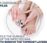 Scholl Kalknagel Behandelset - 1 Stuk - Afbeelding 2