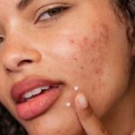 Dermalogica Post Breakout Fix 15ml - Afbeelding 3