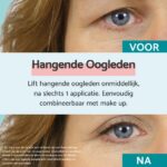 Remescar tegen Hangende Oogleden - Alternatief voor ooglidstickers en ooglidtape, Ooglidcorrectie via ooglid liftende crème, Anti Aging oogcreme, 8 ml voor maar liefst 160 applicaties - Afbeelding 3