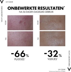 Vichy Capital Soleil UV Clear Anti-onzuiverheden zonnebrand voor het gezicht SPF50+ 40ml voor vette, onzuivere huid met neiging tot acne - Afbeelding 4