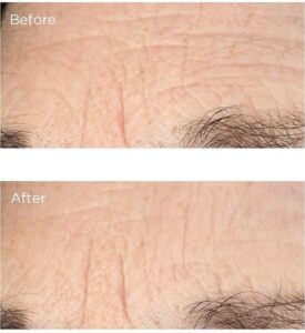 Perricone MD Essential Fx Acyl-Glutathione: Deep Crease Gezichtsserum 30 ml Vrouwen Roze - Afbeelding 4