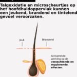 L'Oréal Professionnel Scalp Advanced Anti-Discomfort Intense Soother Treatment - Conditioner voor een gevoelige hoofdhuid - 200ml