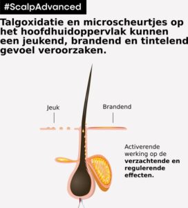 L'Oréal Professionnel Scalp Advanced Anti-Discomfort Intense Soother Treatment - Conditioner voor een gevoelige hoofdhuid - 200ml