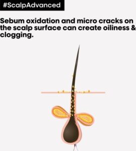 L’Oréal Professionnel - Scalp Advanced - Anti-Oiliness - Haarmasker voor slap, futloos of vet haar - 250 ml - Afbeelding 3