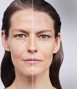 Shiseido Bio Performance Skin Filler Serum Lote 2 Piezas - Afbeelding 4