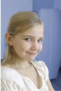 3M Nexcare - Steri-Strips Wondhechtstrips - 8 stuks - Afbeelding 2