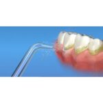 Waterpik Jt 100 Jet Tips   Attachment For Water Flossers   2 Pieces   Silver