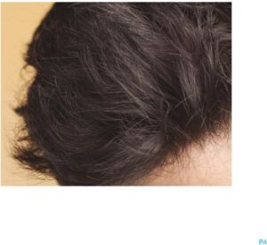 Rene Furterer Style Texturing Spray Volume And Maintenance 200ml - Afbeelding 3