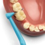 TePe Angle Interdentale Ragers Mixed Pack ISO maat 1 - 6 – (0,4 mm – 0,8 mm) - Afbeelding 4