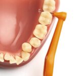 TePe Angle Interdentale Ragers Oranje ISO maat 2 – 0,45 mm (6 stuks) - Afbeelding 3