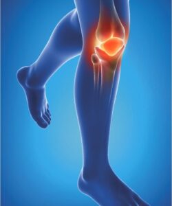 Epitact Physiostrap Medical Kniebeschermer Maat M 1ST - Afbeelding 3