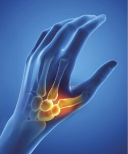 Epitact Flexibele Duimbrace Rechts Maat M 1ST - Afbeelding 8